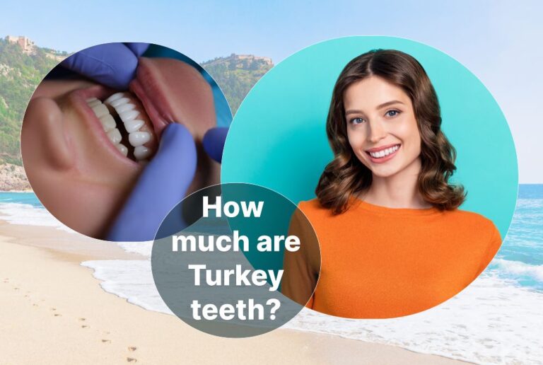 How much are Turkey teeth? Cost of veneers in Turkey
