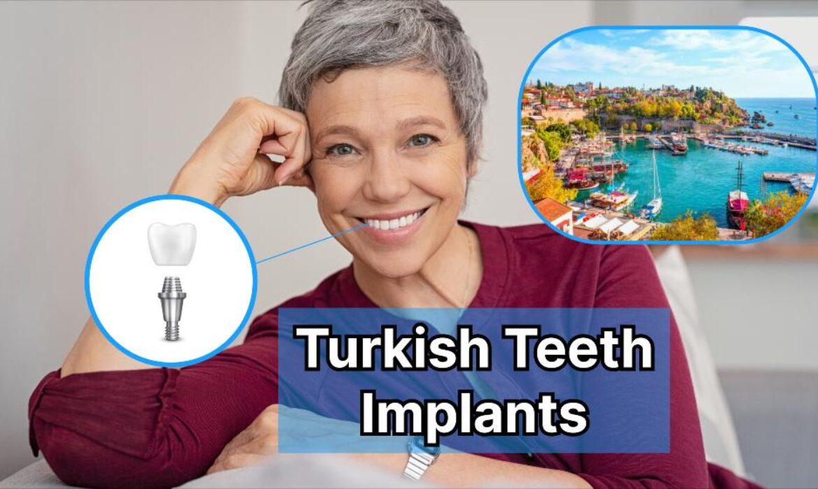 Turkish Teeth Implants Procedure And Price Findglob